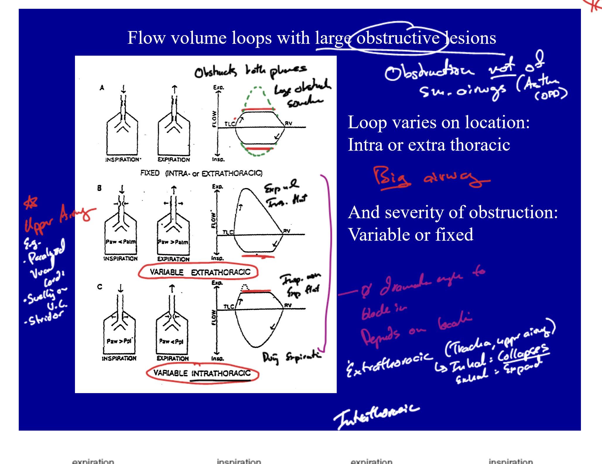 Medical School Slide Notes Example 1